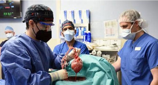 Pig heart transplant in US